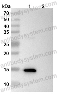 WESTERN BLOT for Anti-Neisseria meningitidis NHBA/Dextranase Antibody (5H2) ?>